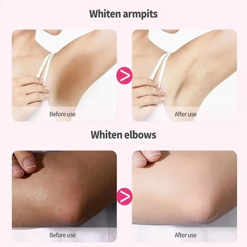 Whitening Cream Private Parts Underarm Bleaching Whiten Butt Knee Brighten Inner Thigh Intimate Parts Dark Remove Melanin Care