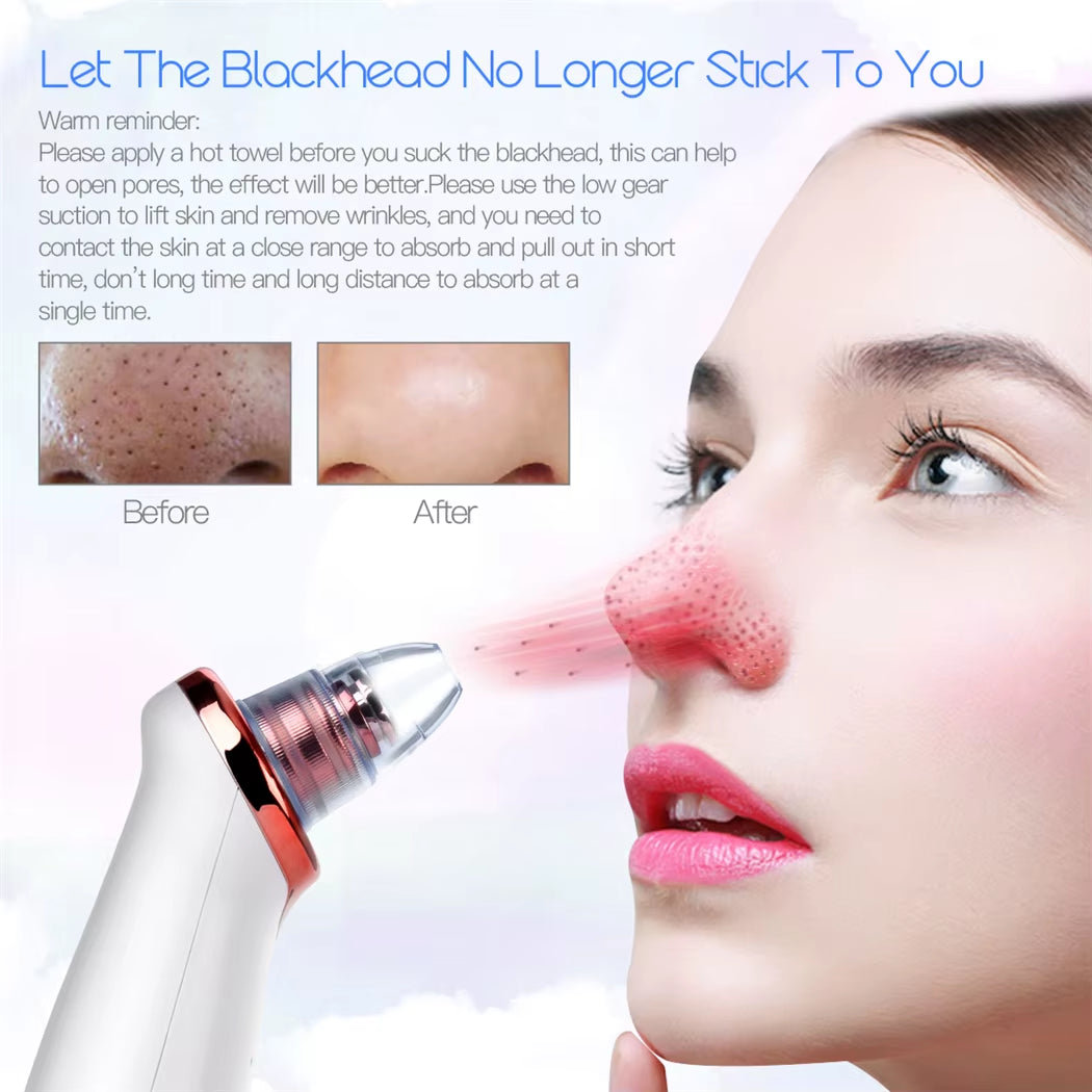 Vacuum Blackhead Remover Electric Facial Acne Cleaner Pimple Pore Cleansing Device Black Nose Point Beauty Skin Care Tool