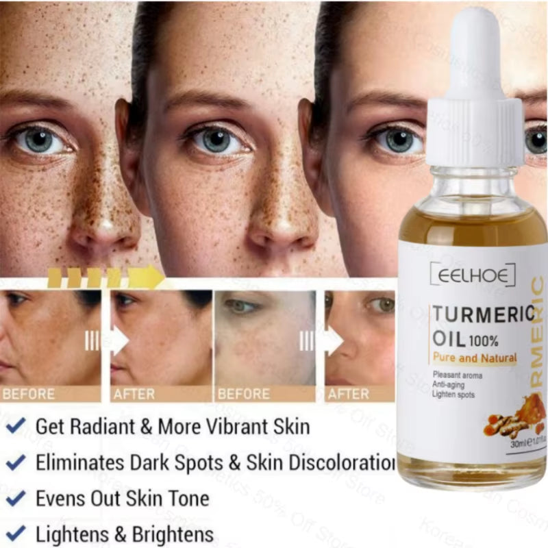 Turmeric Face Whitening Serum Turmeric Anti-Oxidation Serum Remove Dark Spots Melasma Bright Skin Blemish Control Oil Skin Care