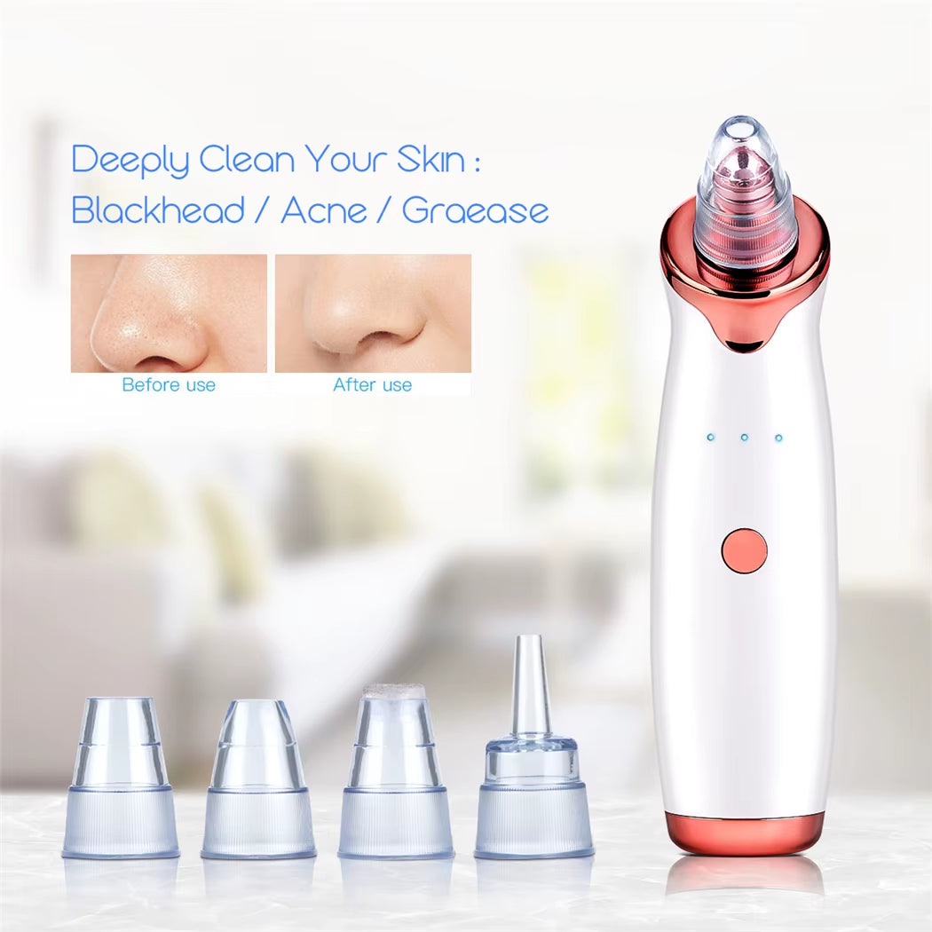 Vacuum Blackhead Remover Electric Facial Acne Cleaner Pimple Pore Cleansing Device Black Nose Point Beauty Skin Care Tool