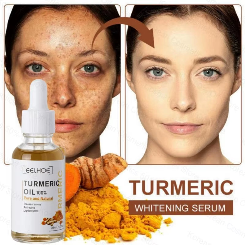 Turmeric Face Whitening Serum Turmeric Anti-Oxidation Serum Remove Dark Spots Melasma Bright Skin Blemish Control Oil Skin Care