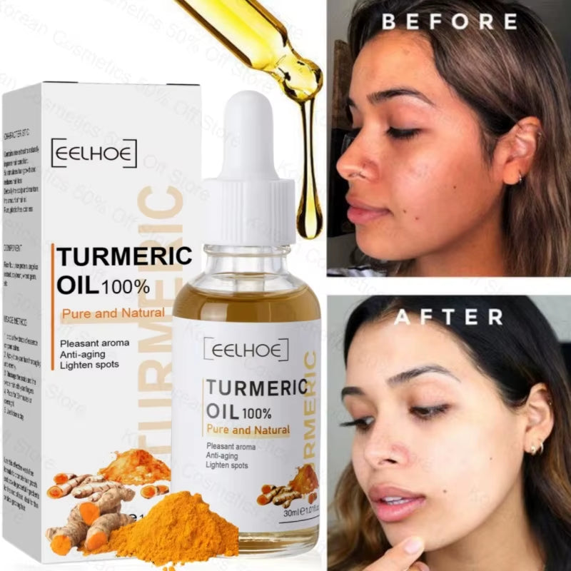 Turmeric Face Whitening Serum Turmeric Anti-Oxidation Serum Remove Dark Spots Melasma Bright Skin Blemish Control Oil Skin Care