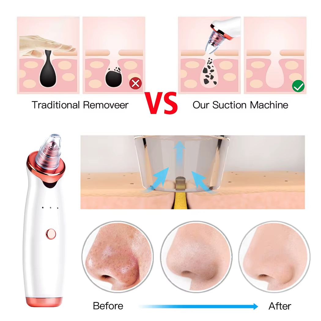 Vacuum Blackhead Remover Electric Facial Acne Cleaner Pimple Pore Cleansing Device Black Nose Point Beauty Skin Care Tool