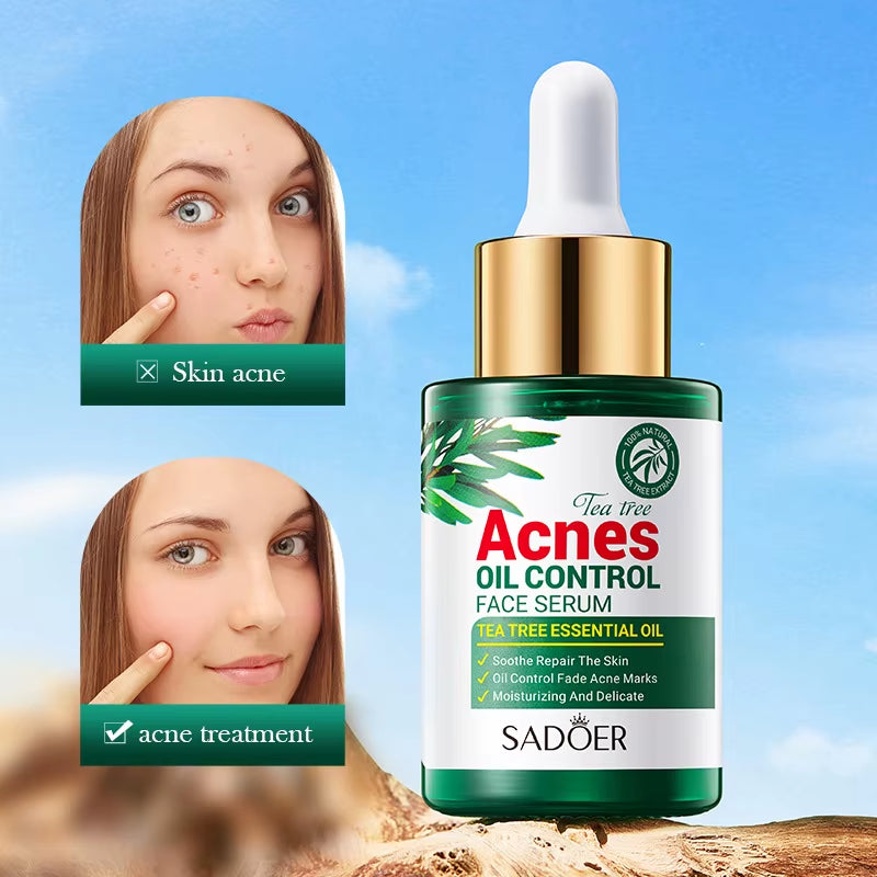 Tea Tree Acne Oil Control Face Serum Shrink Pores Acne Treatment Moisturizing Smooth Firming Skin Beauty Skin Care