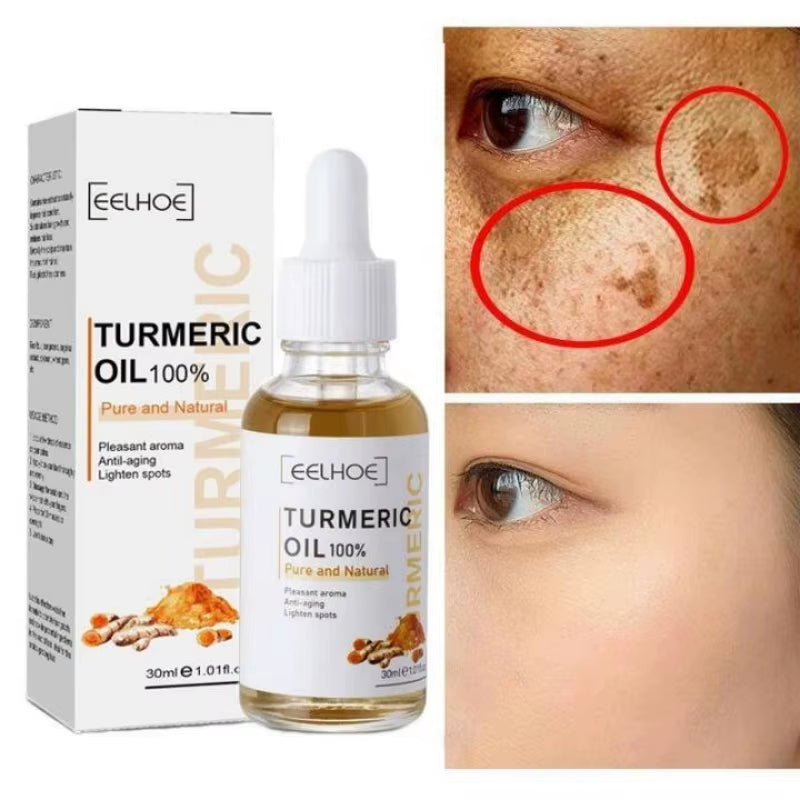 Turmeric Face Whitening Serum Turmeric Anti-Oxidation Serum Remove Dark Spots Melasma Bright Skin Blemish Control Oil Skin Care